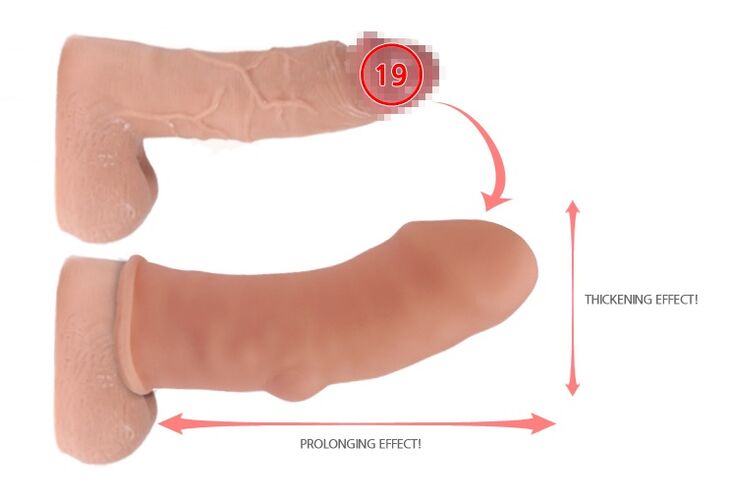 Penisvergrößerung mit Düse